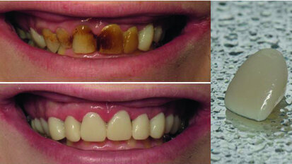 Provisoires et Progiciel, le duo d’experts