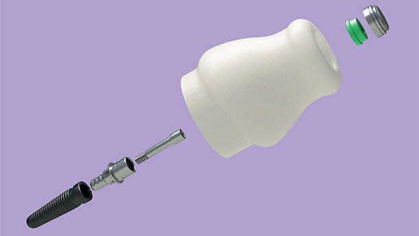 cara YantaLoc – Hét zirkonium attachment