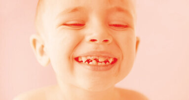 New strategies unveiled to combat tooth decay in young children