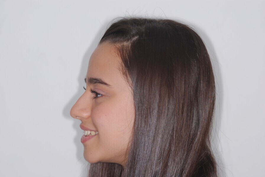 Fig. 3: Profile before treatment.