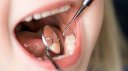 Amsterdamse tandarts biedt gratis controle aan