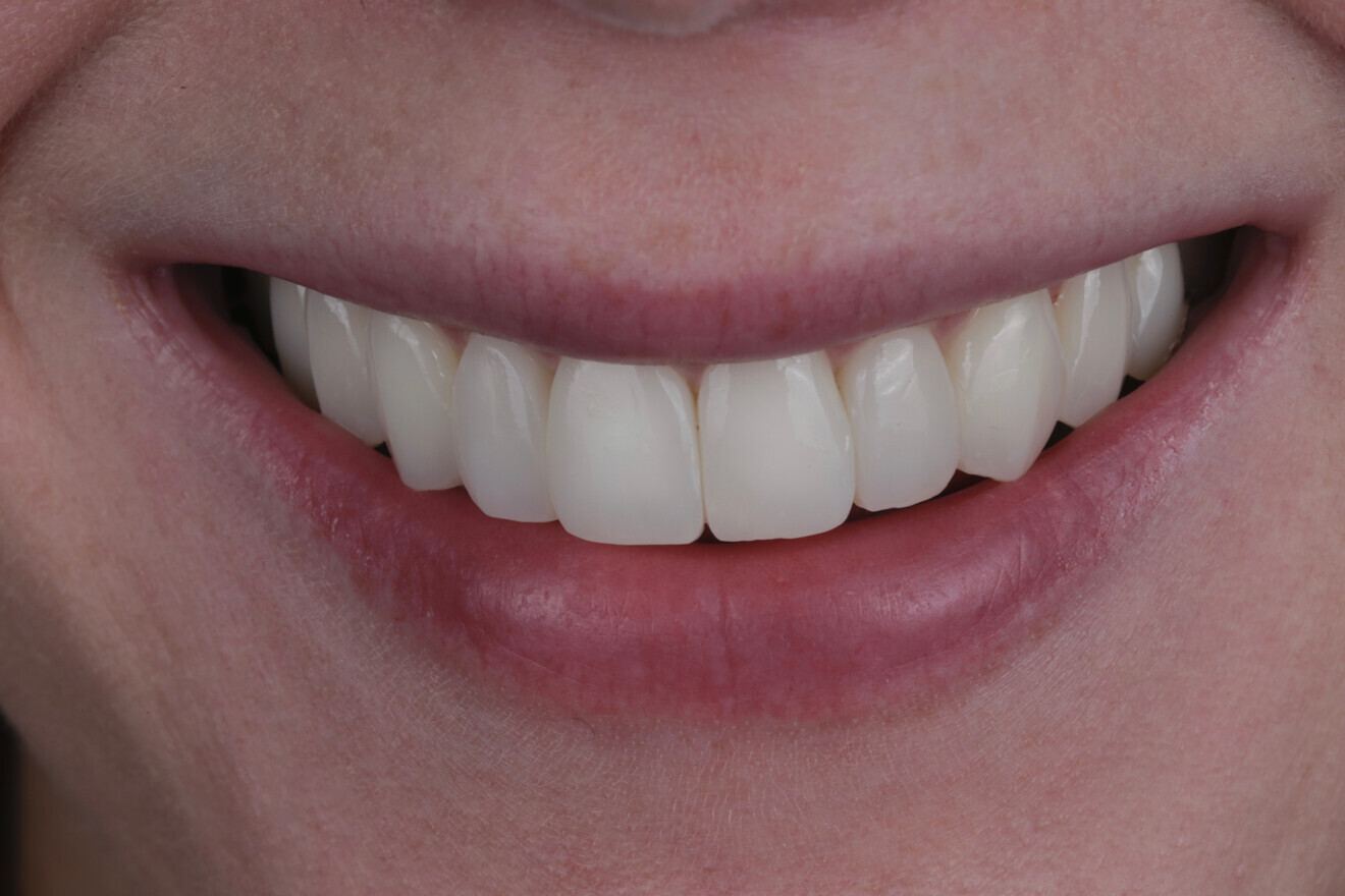 Patient after treatment. (Image: Freshdental) 
