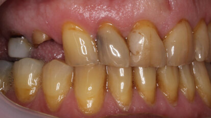 Unconventional applications of dental 3D printing