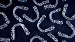 AI and aligners: Efficiency without losing clinical oversight