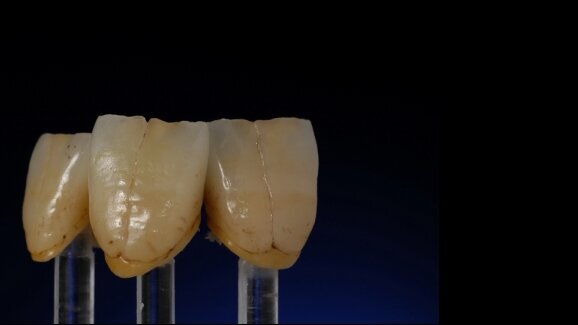 Technologia vs Sztuka