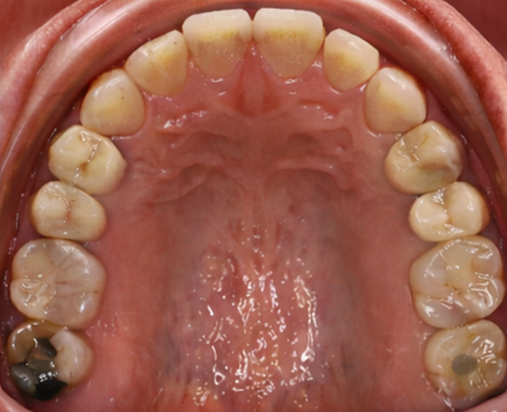 Fig. 12d