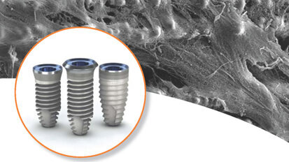 BioHorizons files for $100 million IPO BioHorizons files for $100 million IPO