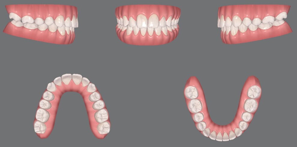 Figs. 24a–e: Final digital models.