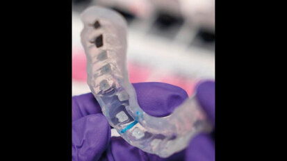 Bonding digitale 3M: vi invitiamo a scoprire le innovazioni per un bonding ortodontico preciso ed efficiente