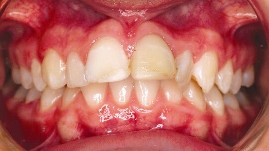 Rimuginando sulla verità