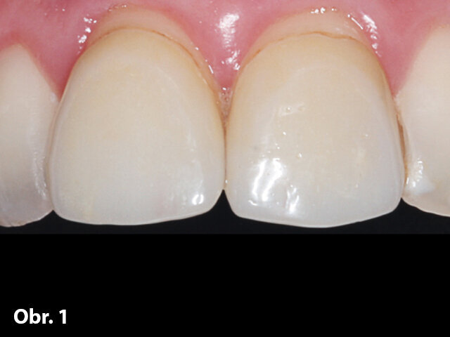 Obr. 1: Počáteční situace