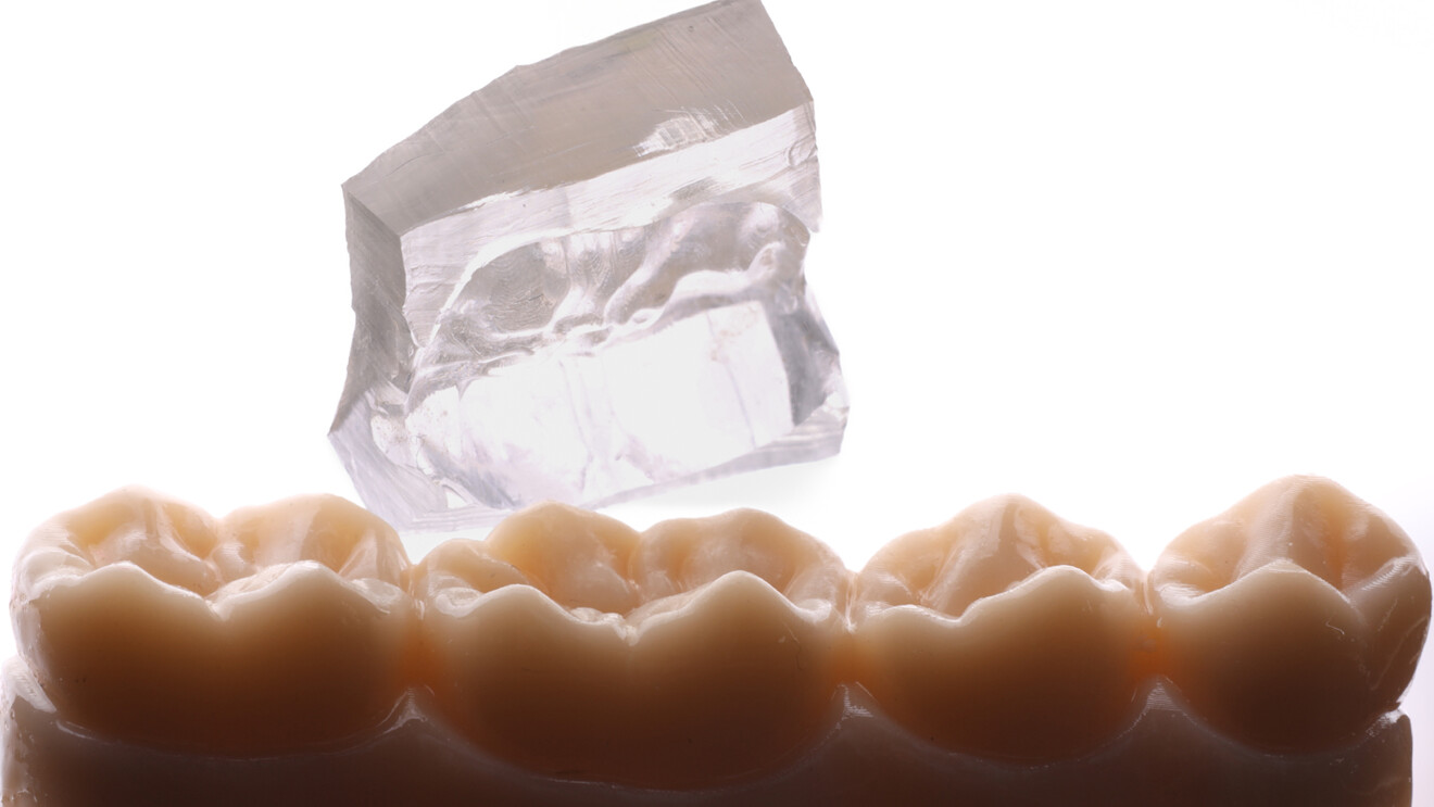Fig. 13 : Clé en silicone transparente définitive, prête pour l’utilisation intraorale.