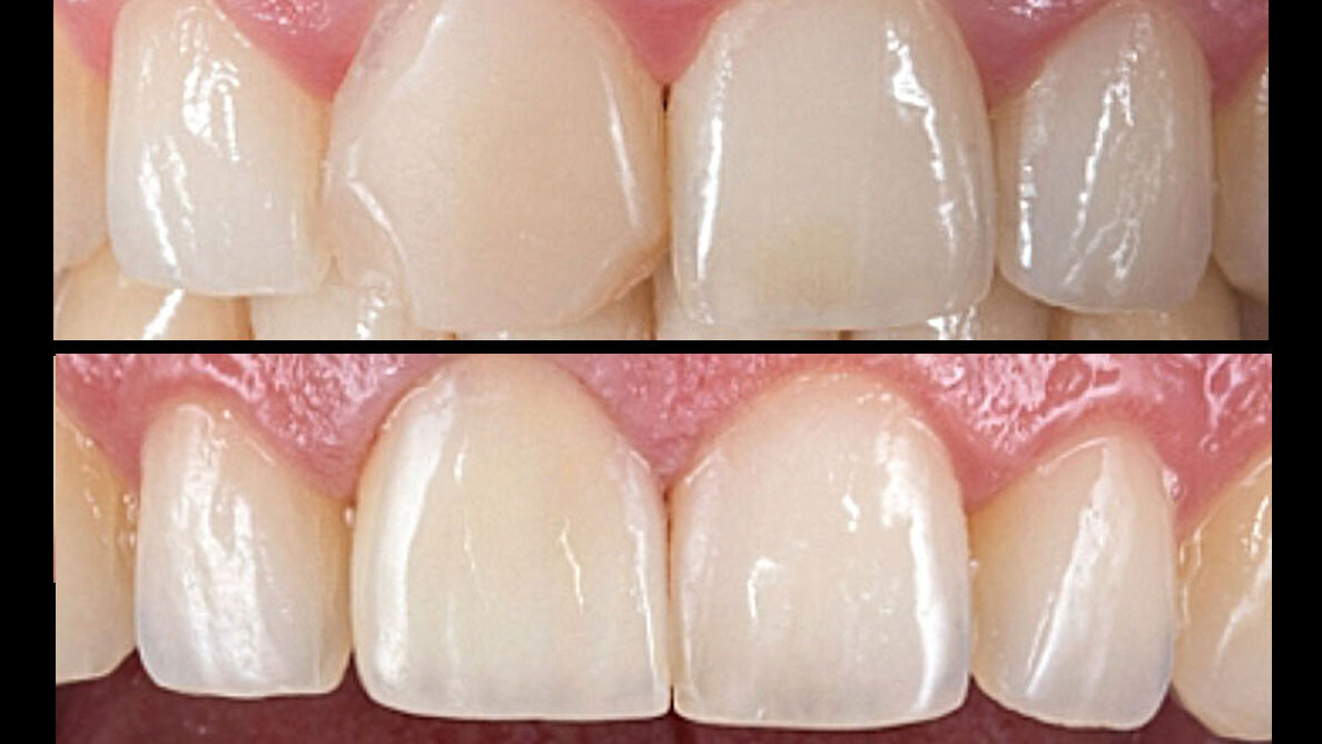 Determinación y reproducción del color