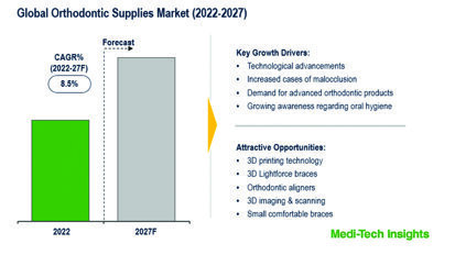 Growing burden of malocclusion likely to increase demand for orthodontics supplies