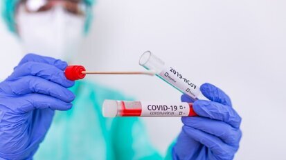 COVID-19: indagini e test epidemiologici. Proposta AIO al Ministro della Salute Roberto Speranza