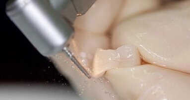 Inlay-Restauration:  Experte erläutert Anwendungsmöglichkeiten