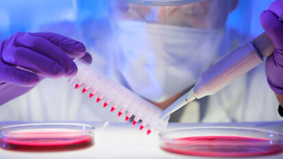 Ricercatori del dentale impegnati a perfezionare il test dell’HIV nei Paesi in via di sviluppo