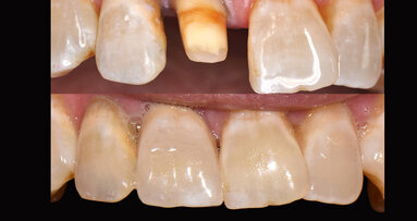 Un delicado juego de luces y colores