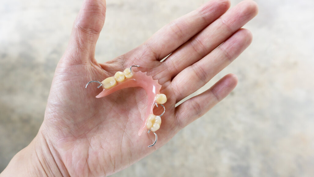 LCMD makes easy CPD designing, wax-up 