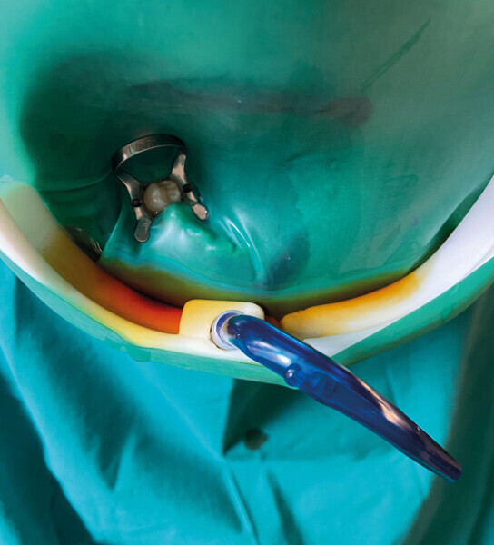 Fig. 13 : Réceptacle des liquides. 