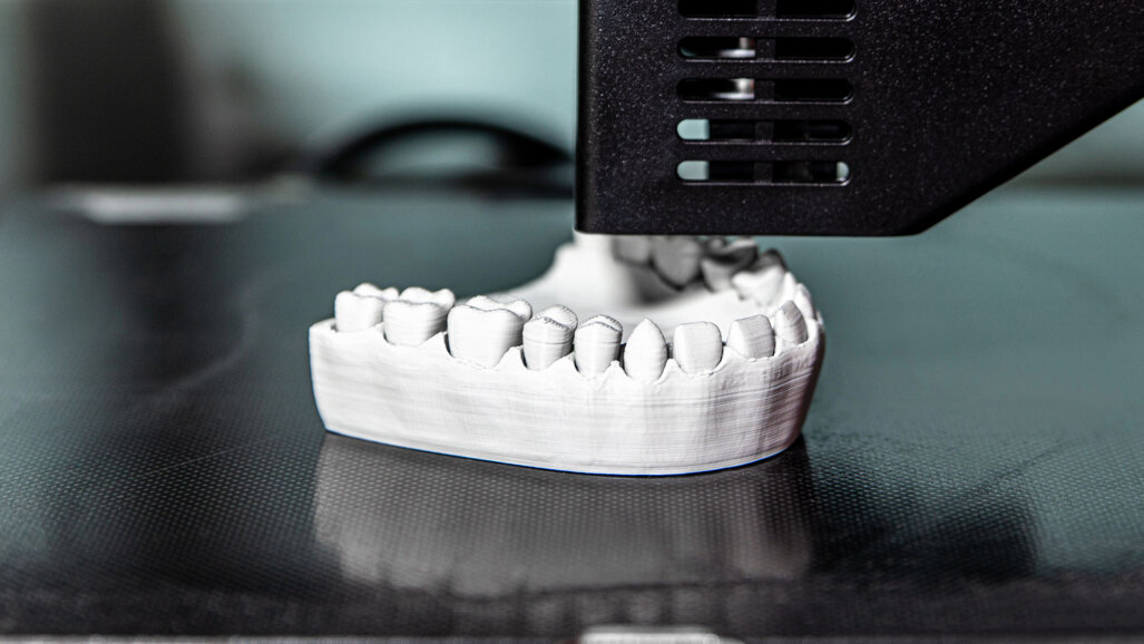 3D printing moves closer to definitive restorations