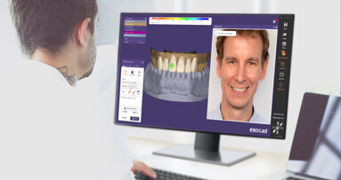 Exocad introduces DentalCAD 3.1 Rijeka software