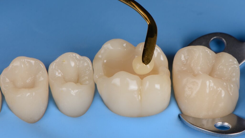 Free webinar highlights advantages of biomimetic approach to dentistry