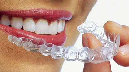 Spotlight on Invisalign: Pros and cons of treatment planning with clear aligners Spotlight on Invisalign: Pros and cons of treatment planning with clear aligners