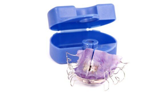 Retainer usage under investigation