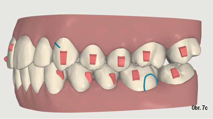 Kazuistika - popis v textu