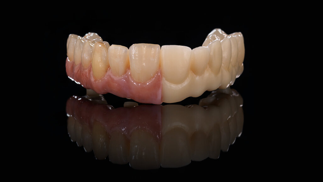 Zolid Bion: Amann Girrbach traz nova zircônia ao mercado