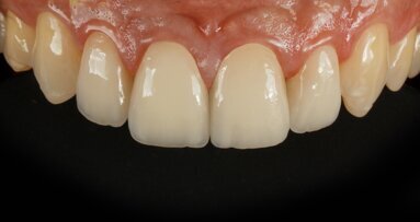 Free webinar puts pre-crystallised glass-ceramics in focus