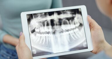 Kemik İyileşme Sürecini Hızlandıran Buluş