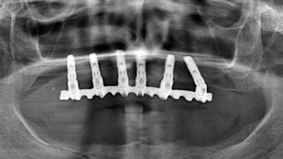 Studio pilota su 396 impianti