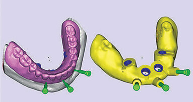 Reduce treatment time with digital dentistry