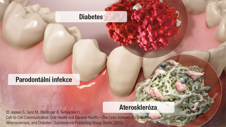 Holistické spojení mezi orálním a celkovým zdravím