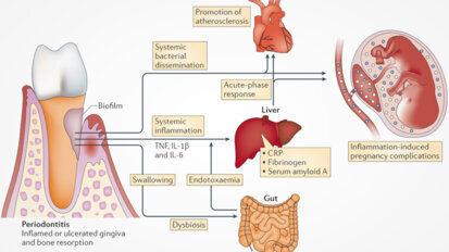 Periodontist Dr Chris Barker talks successful periodontitis treatment