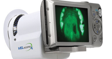 Study documents value of a device in fighting oral cancer