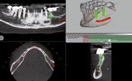 Fig. 4 - Progettazione impianto 35.