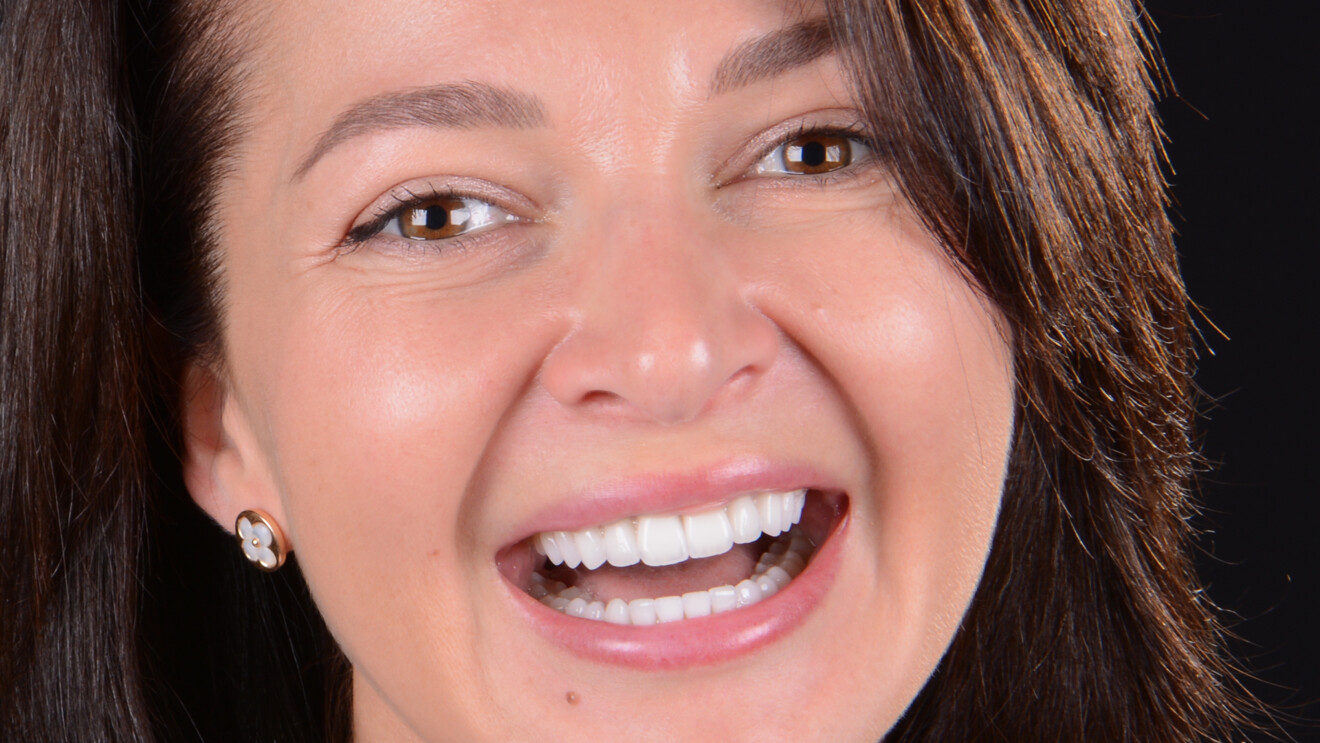 Fig. 33: New smile exceeding expectations.