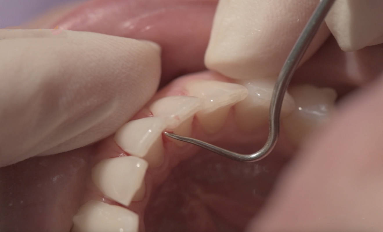 Fig. 12: Checking contacts for sharp edges.