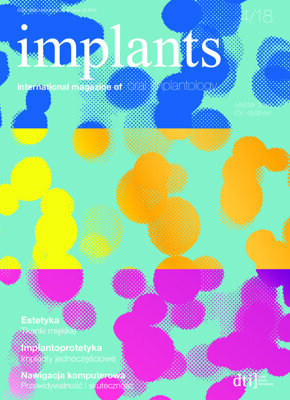 implants Poland No. 4, 2018 implants Poland No. 4, 2018