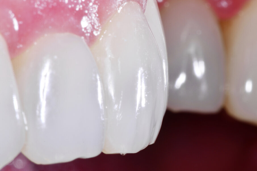 Figs. 22: Detailed view