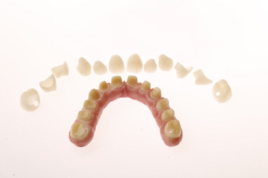 Fig. 6c: Single-crown design on different framework materials for easy repair.