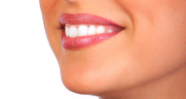 White wine can increase tooth staining