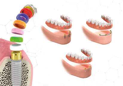 Daekwang IDM – Kerator