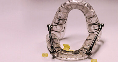 Aparatología de avance mandibular para Apnea del Sueño (2)