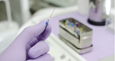 Study shows 87% of patients satisfied with having chosen root canal treatment