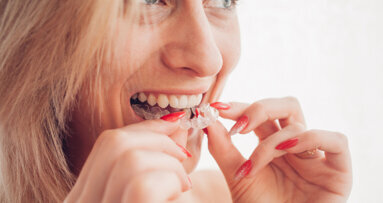 Study establishes patient motivations for seeking clear aligner therapy across five European countries