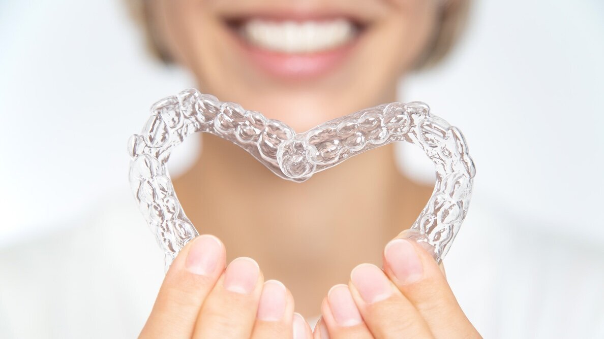 Los alineadores dentales: ¡En boca de muchos, en manos de pocos!